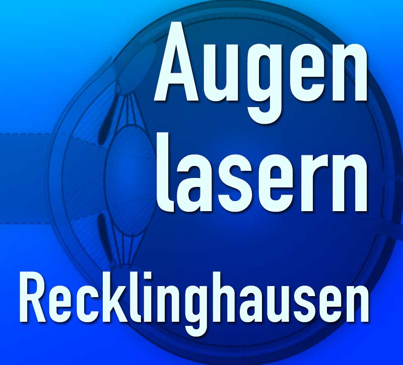 Augen Lasern In Recklinghausen Kosten Kliniken